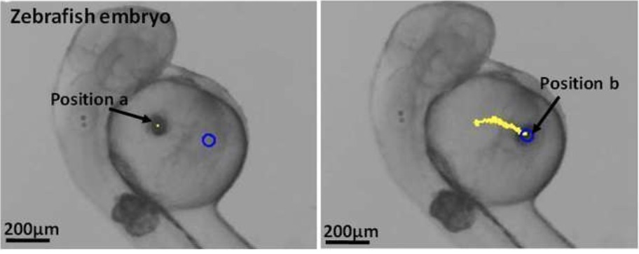 Magnetic Microscopic Medical Robots