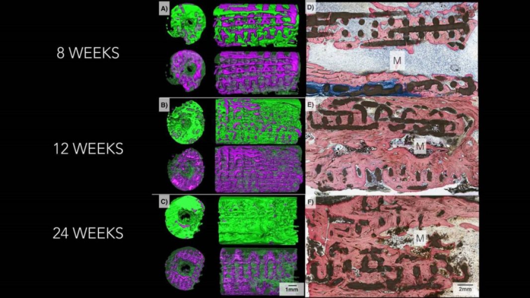 NYU Researchers 3D Print Growing Bone Implants