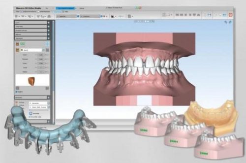 Shining 3D Collaborates With AGE For Accelerating Dental Solution - 3D ...