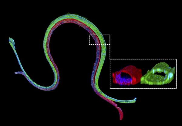 Bioprinted Tubules Simulate Kidney Functions & Diseases