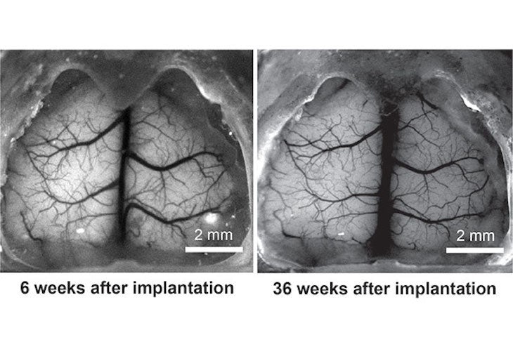 See-Shell: Printed Transparent Skulls Aid in Brain Research