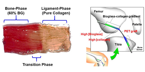 4D printing for ligaments