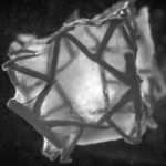 ETH Zurich Develops 3D Printed Heart Patch That Integrates with Cardiac Tissue