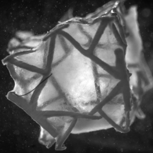 ETH Zurich Develops 3D Printed Heart Patch That Integrates with Cardiac Tissue