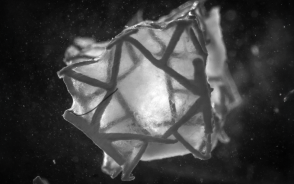ETH Zurich Develops 3D Printed Heart Patch That Integrates with Cardiac Tissue