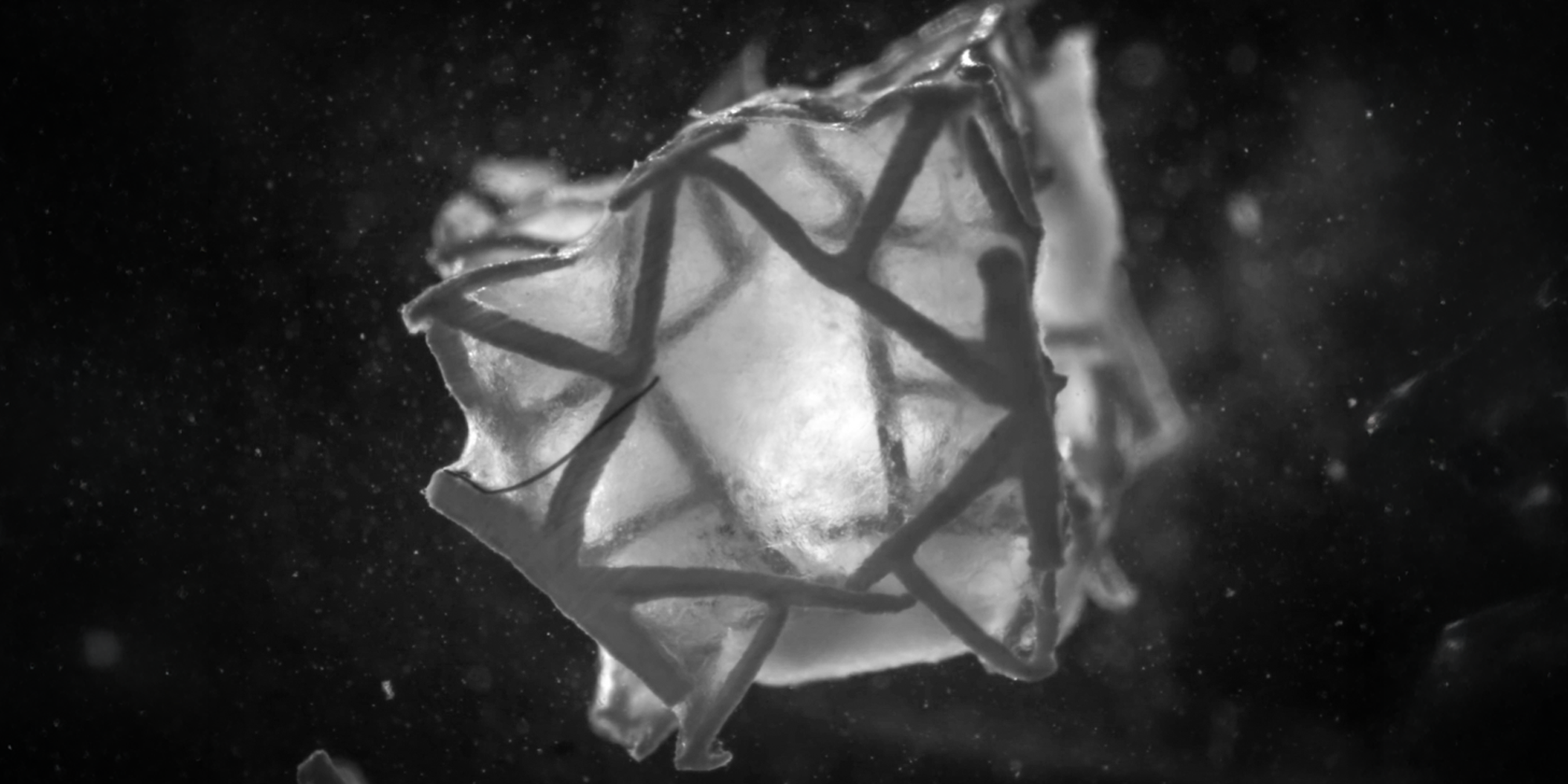 ETH Zurich Develops 3D Printed Heart Patch That Integrates with Cardiac Tissue
