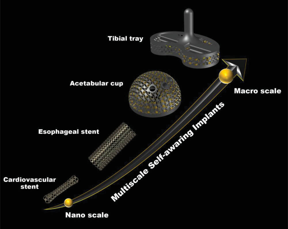 Different scales of implant