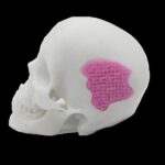 Researchers Develop 3D Printable Bio-Glass for Bone Replacement Applications