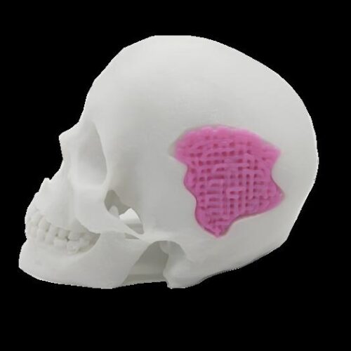 Researchers Develop 3D Printable Bio-Glass for Bone Replacement Applications