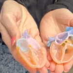 IU Health Opens FDA-Cleared 3D Print Studio, Cutting Model Turnaround to 24 Hours