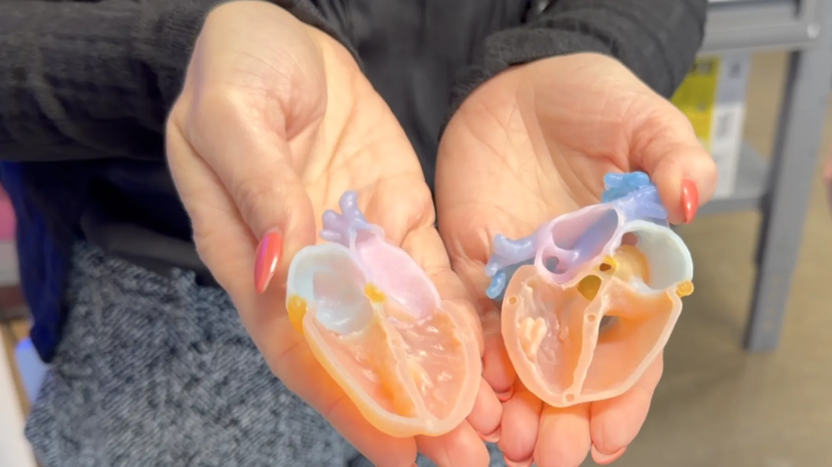 IU Health Opens FDA-Cleared 3D Print Studio, Cutting Model Turnaround to 24 Hours