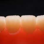 HeyGears Introduces Multi-Material 3D Printed Dentures at Chicago Lab Event