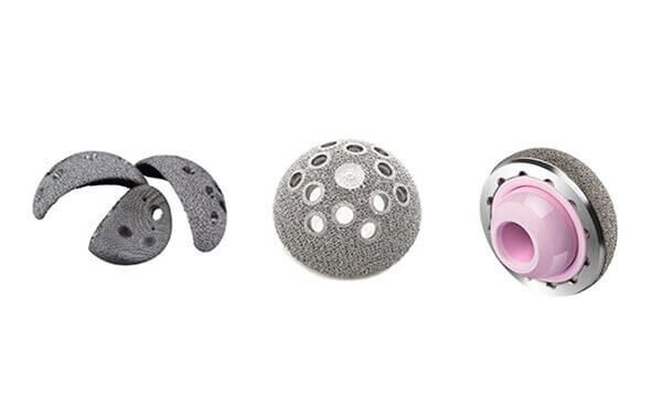 Metal AM Medical Implants Taking off in China