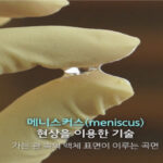 Meniscus lens