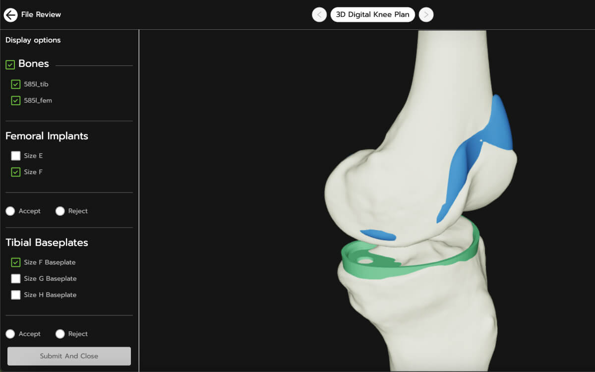 patient-specific 3D models