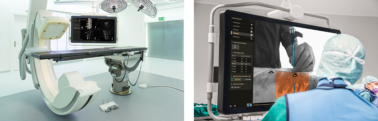 Philips-Hybrid-Operating-Room-with-Surgical-Navigation-Technology