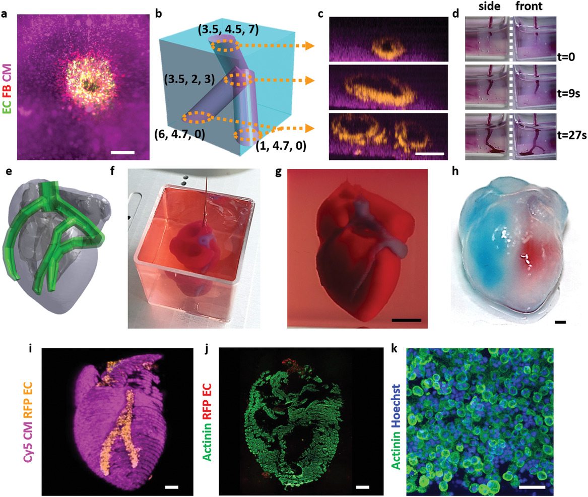 3d printed heart