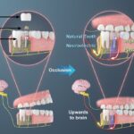 3D-Printed Piezoelectric Tooth Implant Restores Chewing Sensation in 90% of Trial Patients