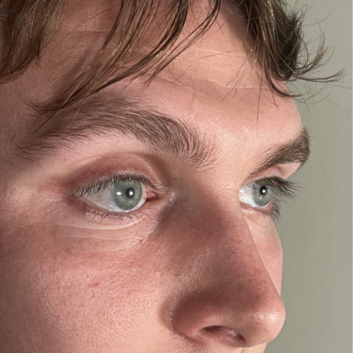 3D Printed Ocular Prostheses to Redefine Quality Standards