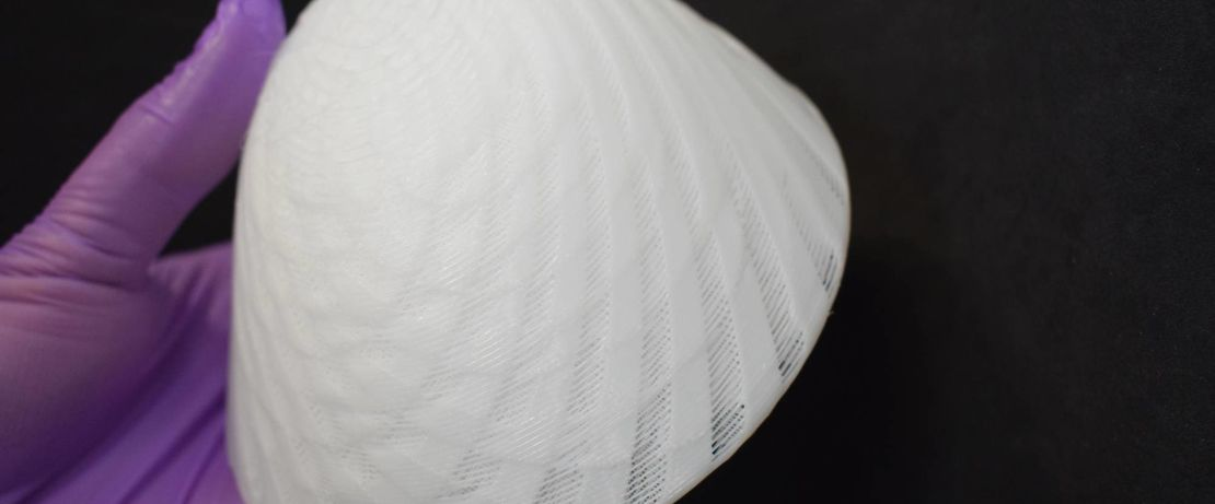 3D printed breast implant