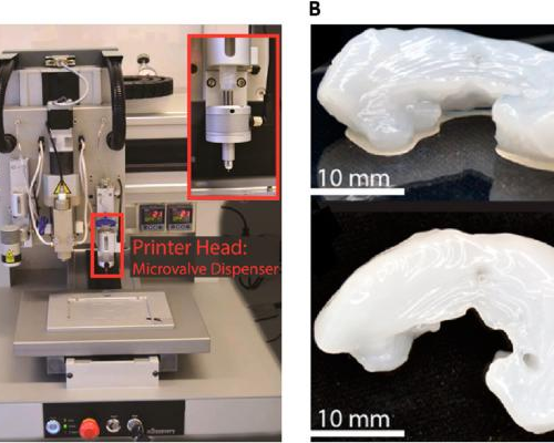 Scottish Researchers Pioneer 3D Printed Hip Replacements Technique