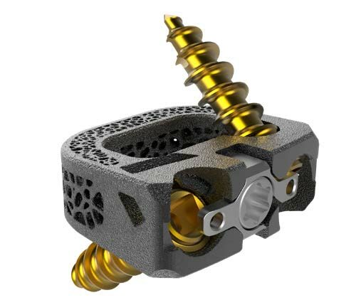 Innosys’ UniSpace Cervical Cage Receives FDA Approval