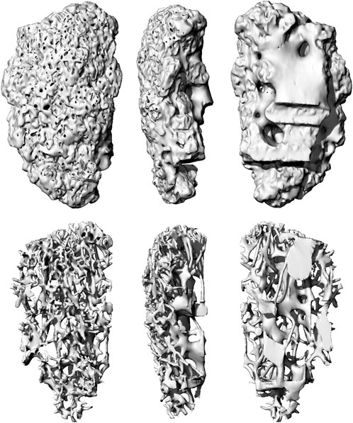 CT scan of egress complex