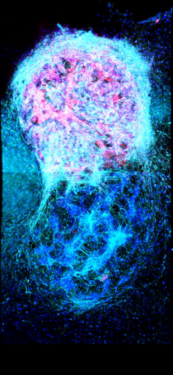 Oxford Researchers Use 3D Printing for Brain Injury Repair - 3D Printing