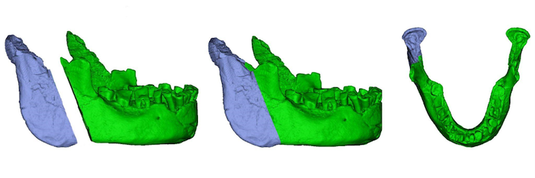 Virtual reconstruction